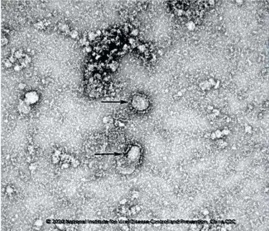 国家病原微生物资源库公布首株新型冠状病毒毒种信息